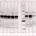 Phoretix1D - Automatic SDS PAGE and Western Blot Analysis Software