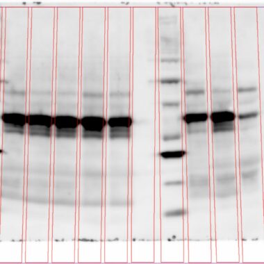 Phoretix1D - Automatic SDS PAGE and Western Blot Analysis Software