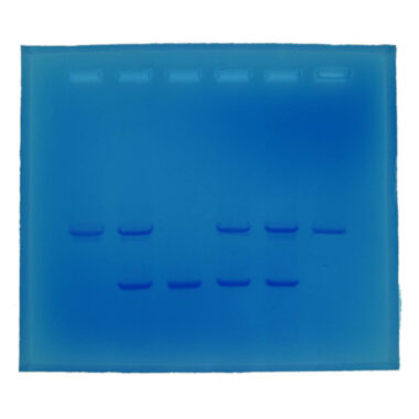 Cystic Fibrosis - Electrophoresis Education kit