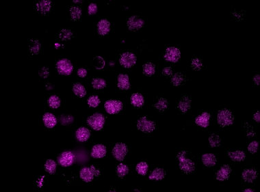 WiScan® Hermes High Content Imaging System with Oil Immersion