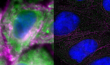 WiScan® Hermes High Content Imaging System with Oil Immersion