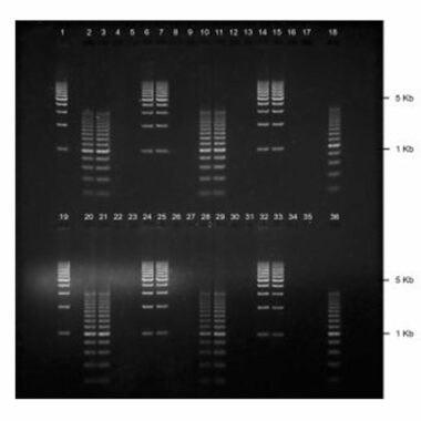 1% Agarose, 1X TAE, 2(16+2), Long, 11.7(w) x 11.7(l) cm, EtBr, 5 gels/Box