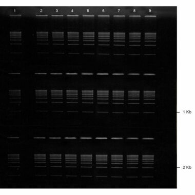 1% Agarose, 1X TAE, 3(8+1), Long, 11.7(w) x 11.7(l) cm, EtBr, 5 gels/Box