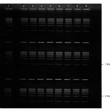 2% Agarose, 1X TAE, 3(8+1), Long, 11.7(w) x 11.7(l) cm, EtBr, 5 gels/Box