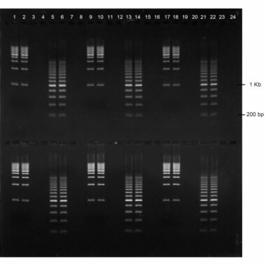 1% Agarose, 1X TAE, 2(24+1), Long, 11.7(w) x 11.7(l) cm, EtBr, 5 gels/Box