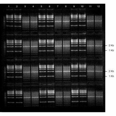 1% Agarose, 1X TAE, 4(12+1), Long, 11.7(w) x 11.7(l) cm, EtBr, 5 gels/Box