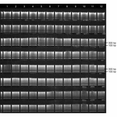 1% Agarose, 1X TAE, 8(12+1), Long, 11.7(w) x 11.7(l) cm, EtBr, 5 gels/Box