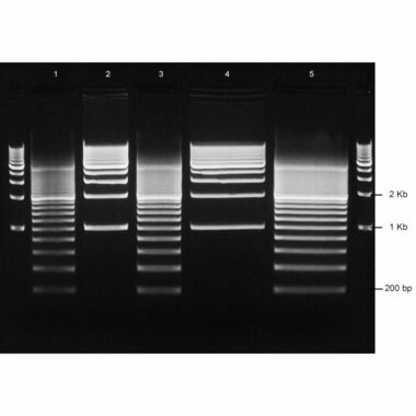 1% Agarose, 1X TAE, 5+2, Medium, 11.7(w) x 8.9(l) cm, EtBr, 5 gels/Box