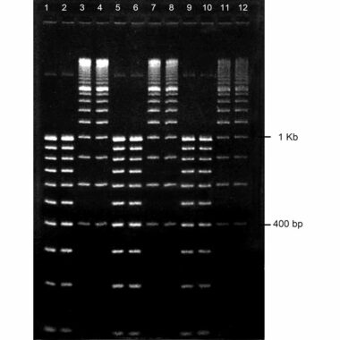 1% Agarose, 1X TAE, 12), Portrait, 6.5(w) x 9.5(l)cm, EtBr, 10 gels/Box