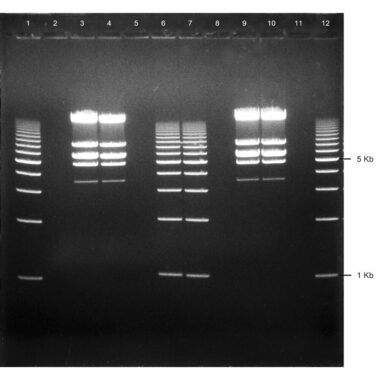 1% Agarose, 1X TAE, 12+1, Portrait, 6.5(w) x 9.5(l)cm, EtBr, 5 gels/Box