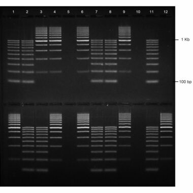 1% Agarose, 1X TAE, 2(12+1), Long, 11.7(w) x 11.7(l) cm, EtBr, 5 gels/Box