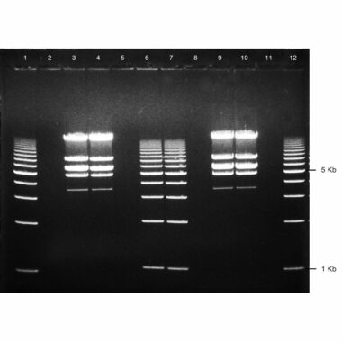 1% Agarose, 1X TAE, 12+1, Medium, 11.7(w) x 8.9(l) cm, EtBr, 5 gels/Box