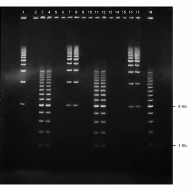 1% Agarose, 1X TAE, 16+2, Long, 11.7(w) x 11.7(l) cm, EtBr, 5 gels/Box