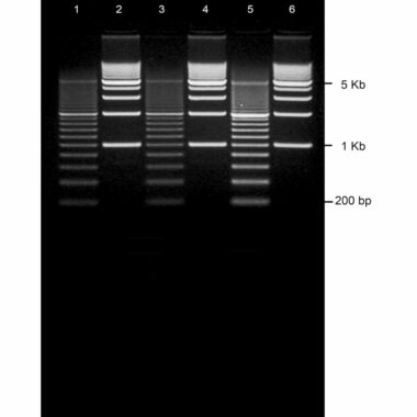 1% Agarose, 1X TAE, 6, Portrait, 6.5(w) x 9.5(l)cm, EtBr, 10 gels/Box