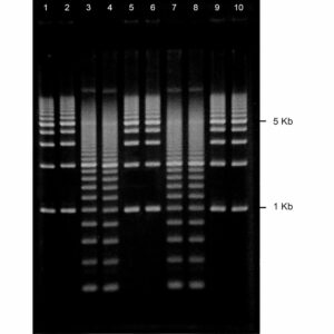 Ethidium Bromide Agarose Gels