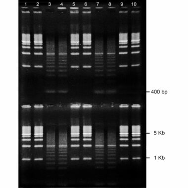 1% Agarose, 1X TAE, 2(10), Portrait, 6.5(w) x 9.5(l)cm, EtBr, 10 gels/Box