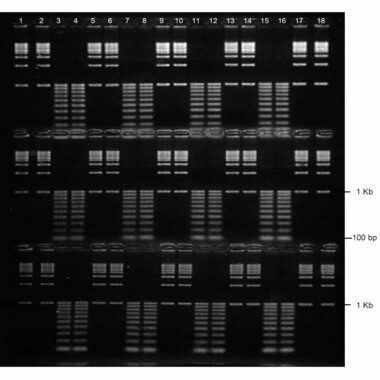 1% Agarose, 1X TBE, 3(16+2), Long, 11.7(w) x 11.7(l) cm, EtBr, 5 gels/Box