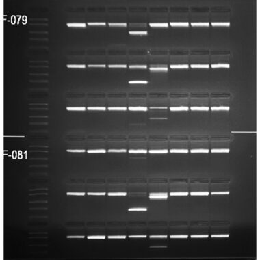 1% Agarose, 1X TBE, 6(8+1), Long, 11.7(w) x 11.7(l) cm, EtBr, 5 gels/Box