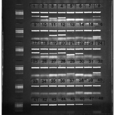 1.5% Agarose, 1X TBE, 6(8+1), Long, 11.7(w) x 11.7(l) cm, EtBr, 5 gels/Box