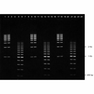 1% Agarose, 1X TBE, 24+1, Medium, 11.7(w) x 8.9(l) cm, EtBr, 5 gels/Box