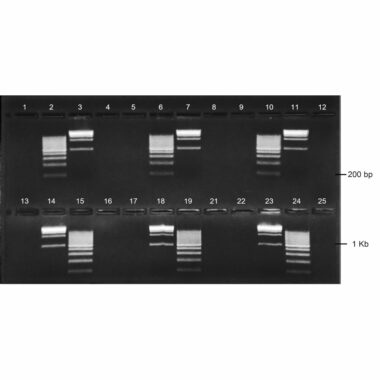 1.5% Agarose, 1X TBE, 2(12+1), Landscape, 11.7(w) x 5.6(l)cm, EtBr, 10 gels/Box