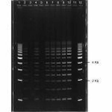 0.8% Agarose, 1X TAE, 12, Portrait, 6.5(w) x 9.5(l) cm, GelGreen, 10 gels/Box