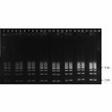 1% Agarose, 1X TAE, 24+1, Landscape, 11.7(w) x 5.6(l)cm, GelGreen, 10 gels/Box