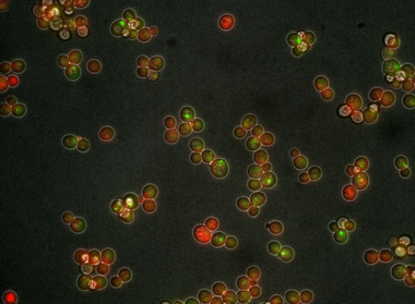 WiScan® Hermes High Content Imaging System with Oil Immersion