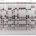 Phoretix1D - Automatic SDS PAGE and Western Blot Analysis Software