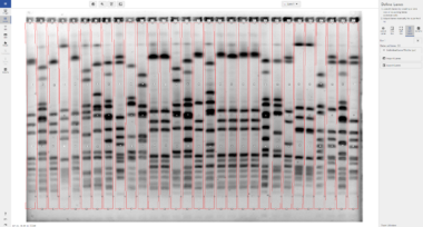 Phoretix1D - Automatic SDS PAGE and Western Blot Analysis Software