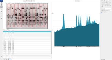 Phoretix1D - Automatic SDS PAGE and Western Blot Analysis Software