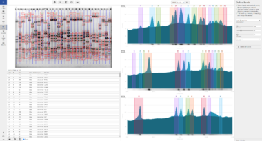 Phoretix1D - Automatic SDS PAGE and Western Blot Analysis Software