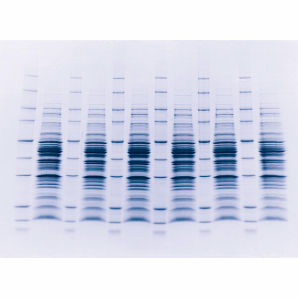 Protein Gel stined bands.jpg