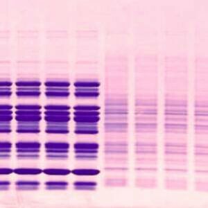 Pre-Cast Gels for Protein