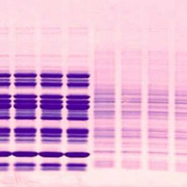 Bis-Tris Gels (Gradient)