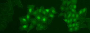 HoloMonitor M4FL Fluorescence Unit