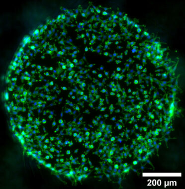 µ-Slide Spheroid Perfusion